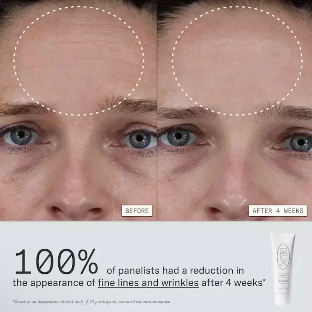 PREORDEN* DIEUX PLUMP + BARRIER BOOST KIT (3 PRODUCTOS)